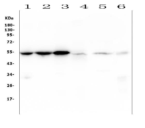1 - Anti-Desmin Antibody Picoband™ (monoclonal, 2B5) ABO14885