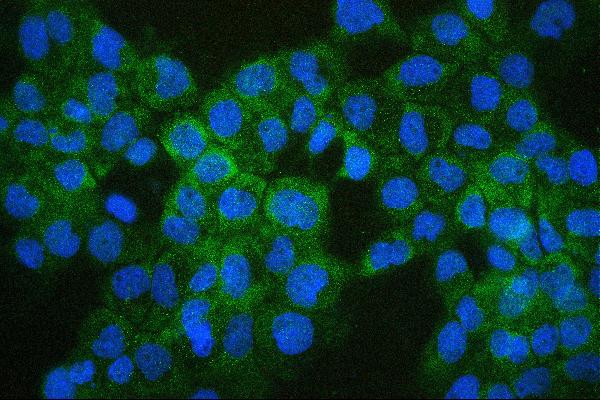 3 - Anti-COMT Antibody Picoband™ (monoclonal, 15C10) ABO14887