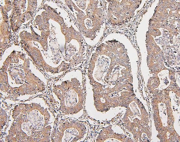 2 - Anti-COMT Antibody Picoband™ (monoclonal, 15C10) ABO14887