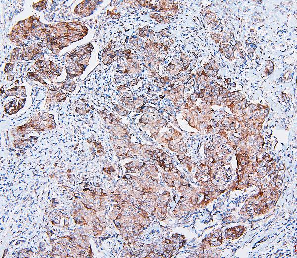 2 - Anti-COMT Antibody Picoband™ (monoclonal, 15C10) ABO14887