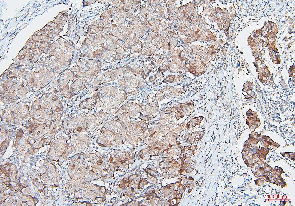 2 - Anti-COMT Antibody Picoband™ (monoclonal, 15C10) ABO14887