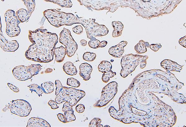 2 - Anti-COMT Antibody Picoband™ (monoclonal, 15C10) ABO14887