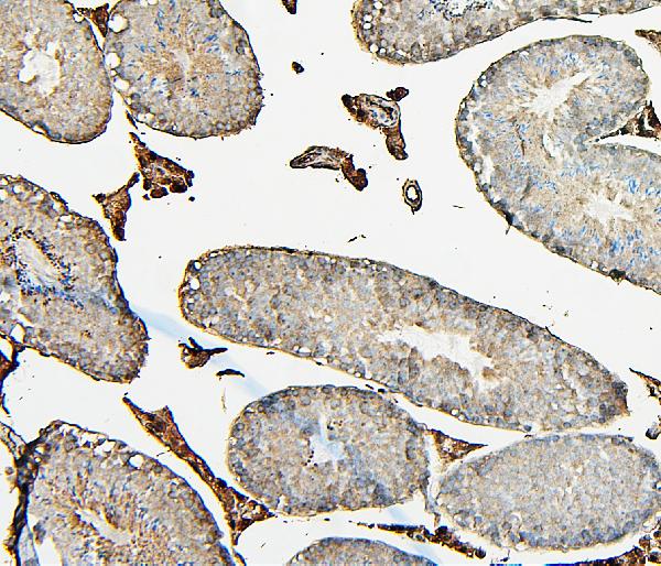 2 - Anti-COMT Antibody Picoband™ (monoclonal, 15C10) ABO14887