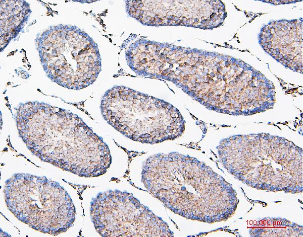 2 - Anti-COMT Antibody Picoband™ (monoclonal, 15C10) ABO14887