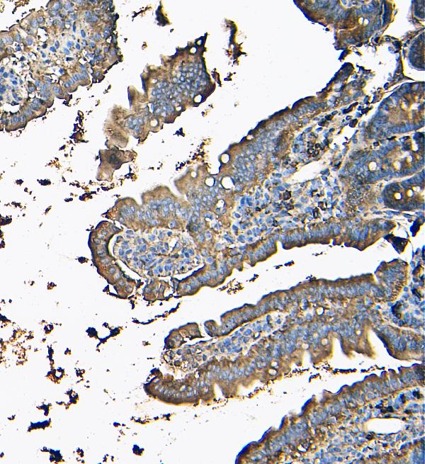 2 - Anti-MVP Antibody Picoband™ (monoclonal, 8B12) ABO14888