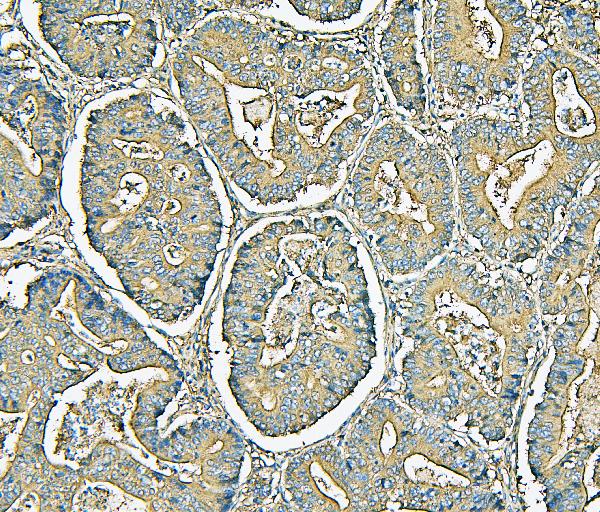 2 - Anti-MVP Antibody Picoband™ (monoclonal, 8B12) ABO14888