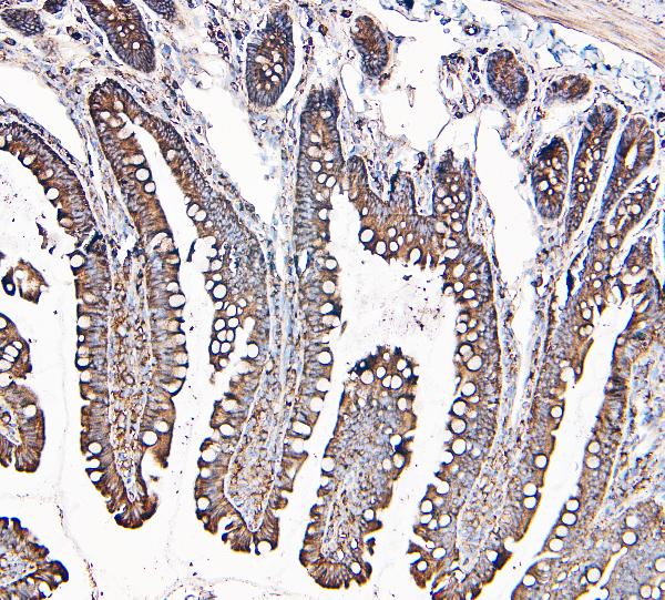 2 - Anti-MVP Antibody Picoband™ (monoclonal, 8B12) ABO14888