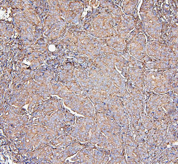 2 - Anti-MVP Antibody Picoband™ (monoclonal, 8B12) ABO14888