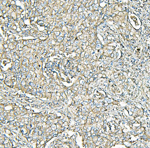 2 - Anti-MVP Antibody Picoband™ (monoclonal, 8B12) ABO14888