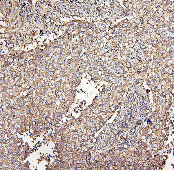 2 - Anti-MVP Antibody Picoband™ (monoclonal, 8B12) ABO14888