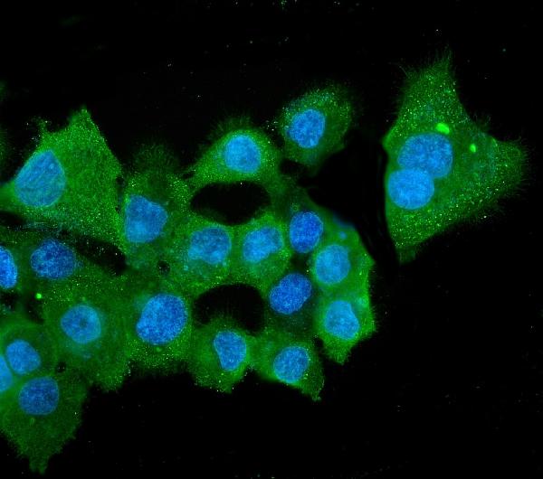 3 - Anti-ALDH2 Antibody Picoband™ (monoclonal, 5G7) ABO14889