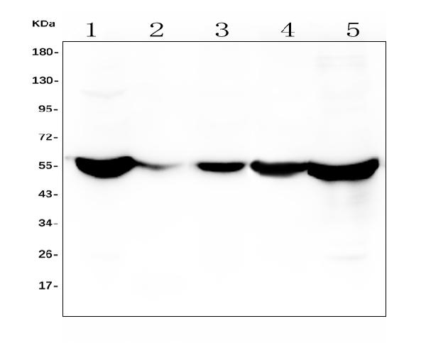 1 - Anti-ALDH2 Antibody Picoband™ (monoclonal, 5G7) ABO14889