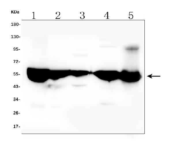 1 - Anti-ALDH2 Antibody Picoband™ (monoclonal, 5G7) ABO14889