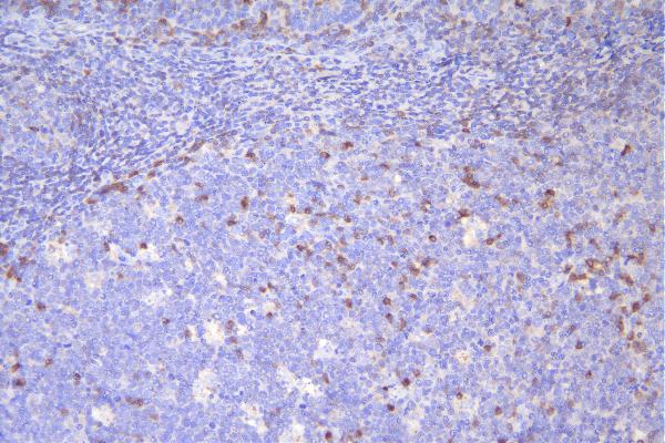 2 - Anti-CD79a Antibody Picoband™ (monoclonal, 4G4) ABO14890