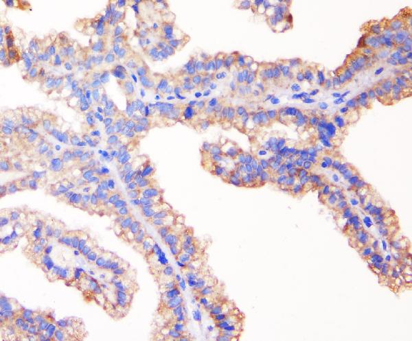 2 - Anti-TJP1 Antibody Picoband™ (monoclonal, 3E12) ABO14891
