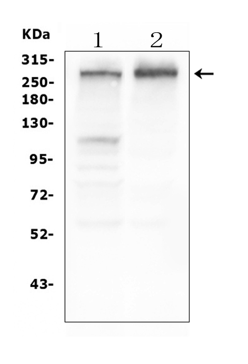 1 - Anti-Tuberin TSC2 Antibody Picoband™ (monoclonal, 6I3) ABO14893