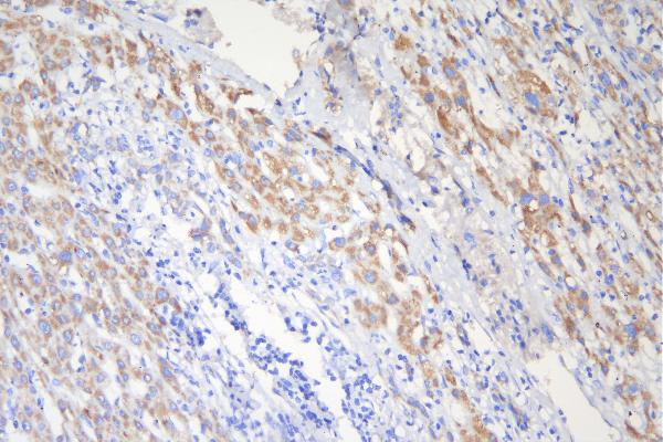 2 - Anti-Tuberin TSC2 Antibody Picoband™ (monoclonal, 6I3) ABO14893