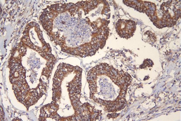 2 - Anti-mtTFA TFAM Antibody Picoband™ (monoclonal, 4D9) ABO14894
