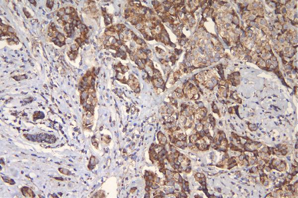 2 - Anti-mtTFA TFAM Antibody Picoband™ (monoclonal, 4D9) ABO14894
