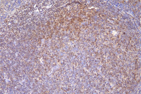 2 - Anti-DCK Antibody Picoband™ (monoclonal, 3G10) ABO14895