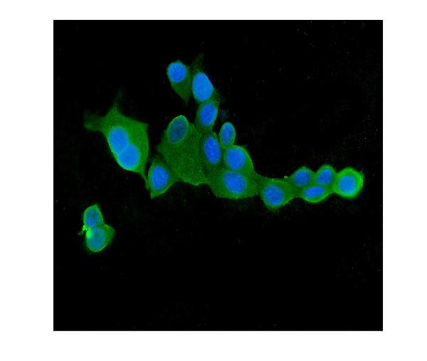 3 - Anti-CLPX Antibody Picoband™ (monoclonal, 11C11) ABO14896