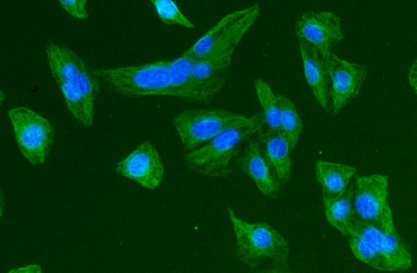3 - Anti-Beta Tubulin TUBB Antibody Picoband™ (monoclonal, 2E11) ABO14897