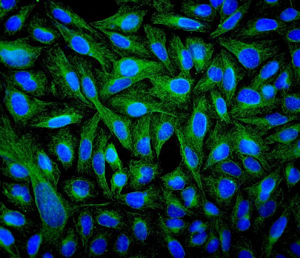 3 - Anti-Beta Tubulin TUBB Antibody Picoband™ (monoclonal, 2E11) ABO14897