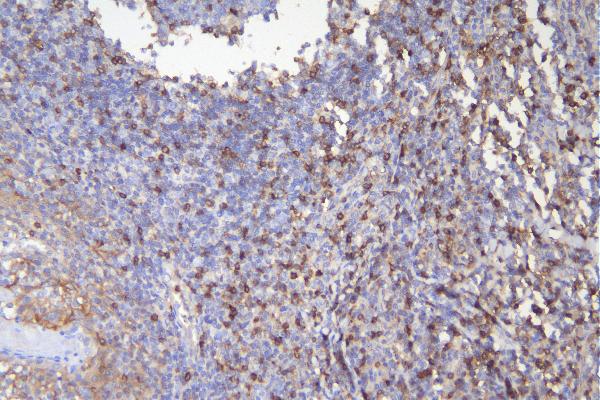 2 - Anti-CD5 Antibody Picoband™ (monoclonal, 4E2) ABO14898
