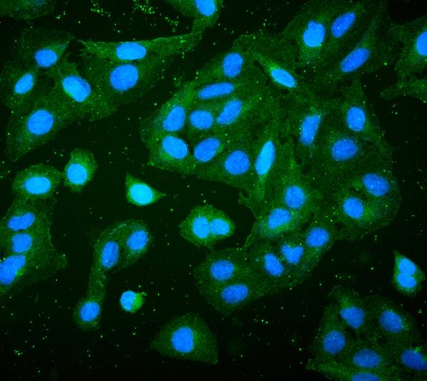 3 - Anti-RP2 Antibody Picoband™ (monoclonal, 3D7) ABO14900