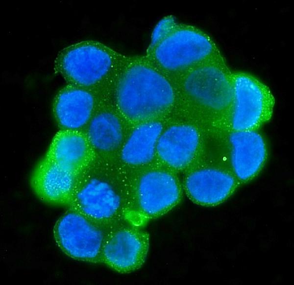 3 - Anti-MPI Antibody Picoband™ (monoclonal, 11I4) ABO14902