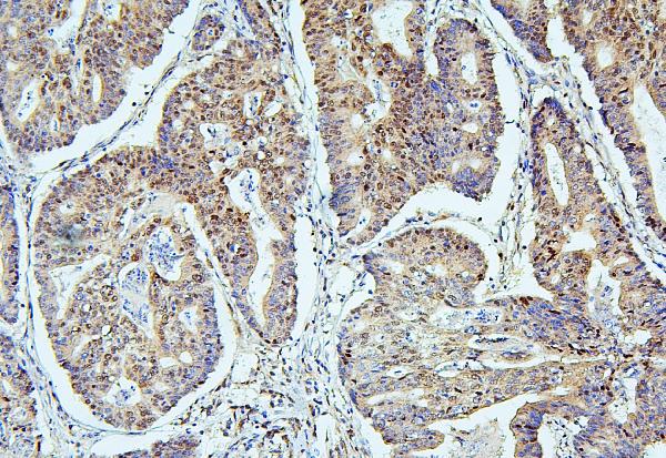 2 - Anti-SAE2/UBA2 Antibody Picoband™ (monoclonal, 5B13) ABO14904