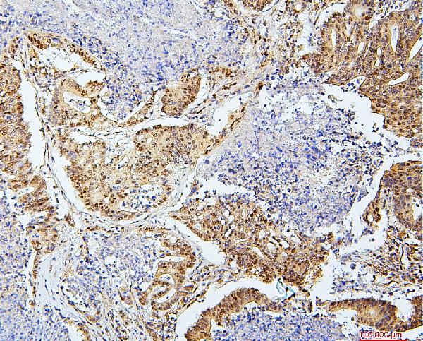 2 - Anti-SAE2/UBA2 Antibody Picoband™ (monoclonal, 5B13) ABO14904
