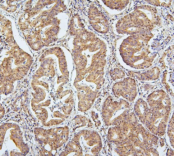 2 - Anti-SAE2/UBA2 Antibody Picoband™ (monoclonal, 5B13) ABO14904