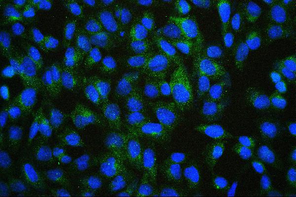 3 - Anti-ALIX/PDCD6IP Antibody Picoband™(monoclonal, 14D10) ABO14908