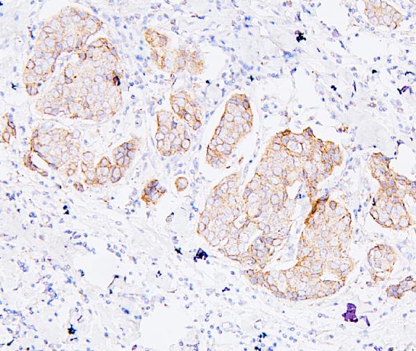 2 - Anti-ALIX/PDCD6IP Antibody Picoband™(monoclonal, 14D10) ABO14908