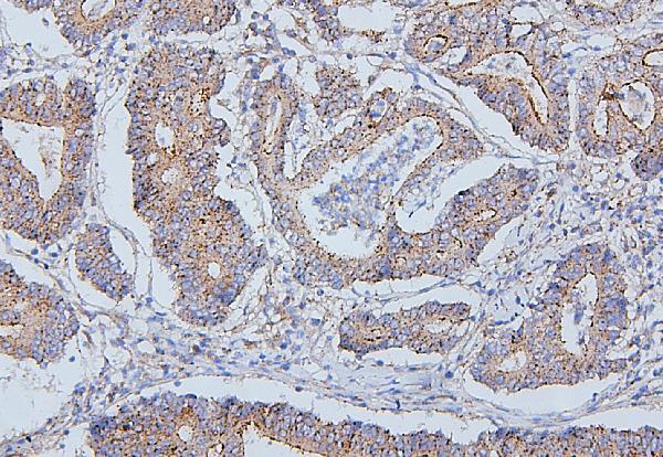 2 - Anti-ALIX/PDCD6IP Antibody Picoband™(monoclonal, 14D10) ABO14908