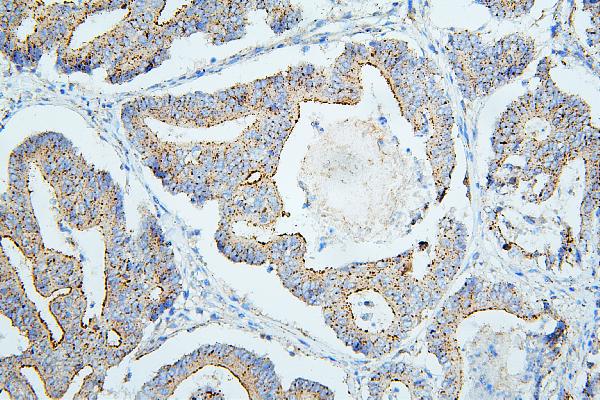 2 - Anti-ALIX/PDCD6IP Antibody Picoband™(monoclonal, 14D10) ABO14908
