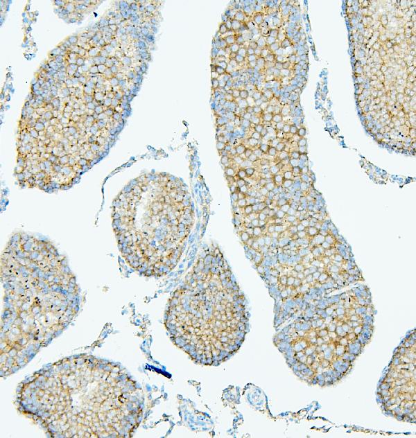 2 - Anti-ALIX/PDCD6IP Antibody Picoband™(monoclonal, 14D10) ABO14908