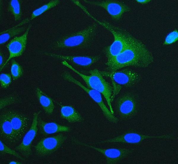 3 - Anti-Cytokeratin 18 KRT18 Antibody Picoband™(monoclonal, 7I6) ABO14909