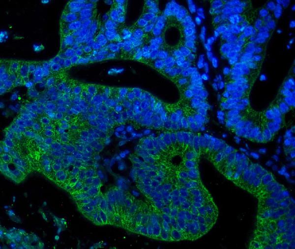 3 - Anti-Cytokeratin 18 KRT18 Antibody Picoband™(monoclonal, 7I6) ABO14909