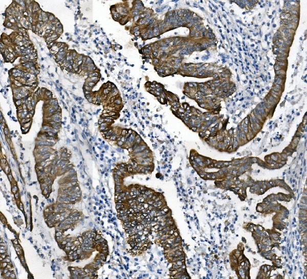 2 - Anti-Cytokeratin 18 KRT18 Antibody Picoband™(monoclonal, 7I6) ABO14909