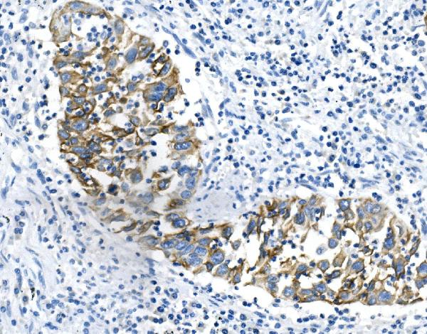 2 - Anti-Cytokeratin 18 KRT18 Antibody Picoband™(monoclonal, 7I6) ABO14909