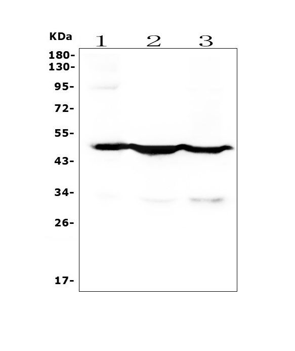 1 - Anti-Cytokeratin 18 KRT18 Antibody Picoband™(monoclonal, 7I6) ABO14909