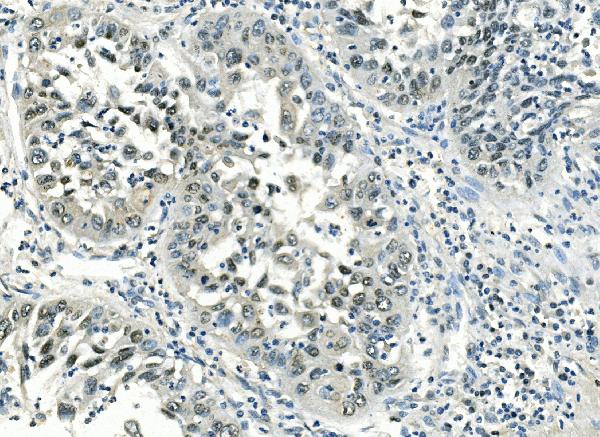 2 - Anti-ATF1 Antibody Picoband™(monoclonal, 7F8) ABO14912