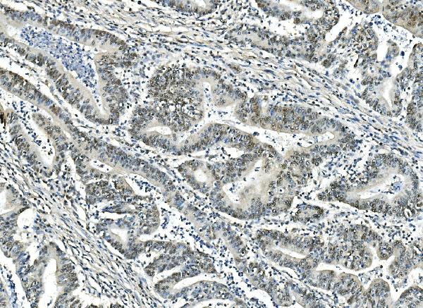 2 - Anti-ATF1 Antibody Picoband™(monoclonal, 7F8) ABO14912