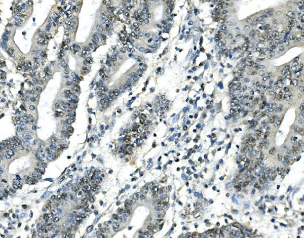 2 - Anti-ATF1 Antibody Picoband™(monoclonal, 7F8) ABO14912