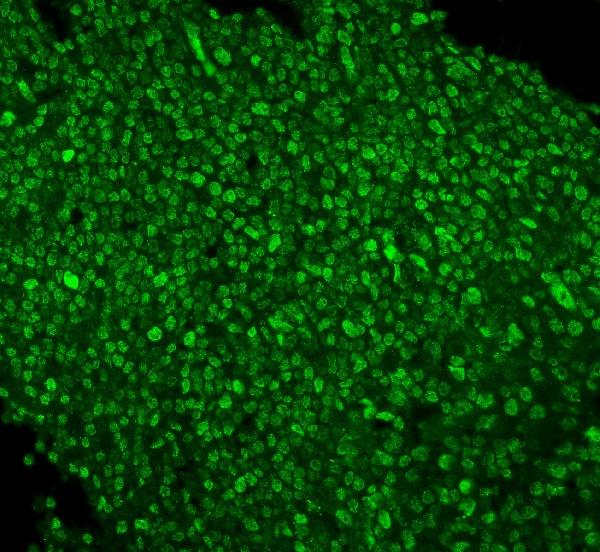 3 - Anti-PTBP1 Antibody Picoband™(monoclonal, 3H12) ABO14913