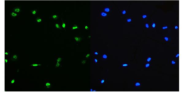 3 - Anti-PTBP1 Antibody Picoband™(monoclonal, 3H12) ABO14913