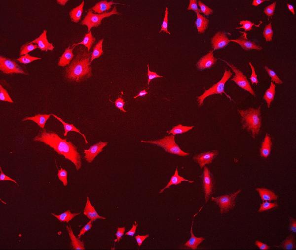 3 - Anti-Hsc70 Antibody Picoband™(monoclonal, 3B6) ABO14915