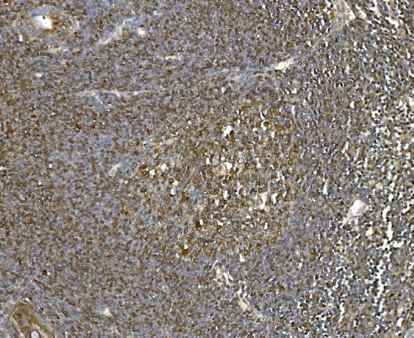 2 - Anti-Hsc70 Antibody Picoband™(monoclonal, 3B6) ABO14915
